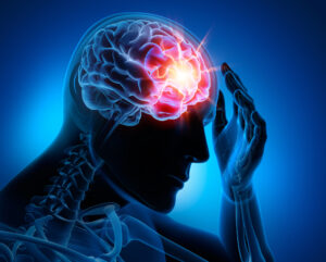 How Labrum Law Firm Personal Injury Lawyers Can Help You Recover Compensation After Suffering Brain Damage in Nashville