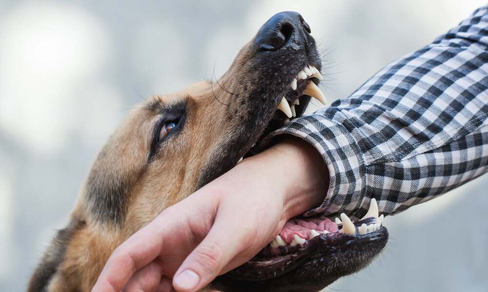 dog bites a hand of a person in Nashville, TN