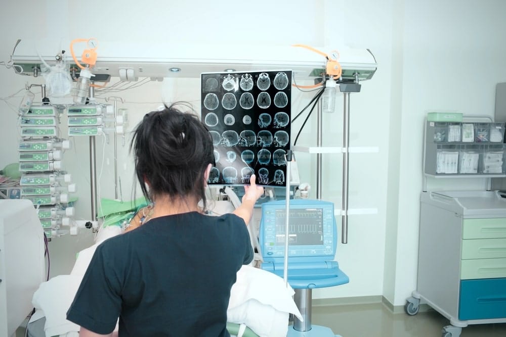 Image is of medical staff reviewing brain scans in hospital, illustrating head trauma risks from motorcycle accidents